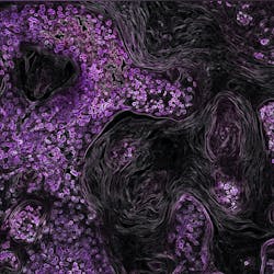 Unsplash National Cancer Institute Zo Fbf T0 M Bu Unsplash 5f47b5ea7b284 Unsplash National Cancer Institute Zo Fbf T0 M Bu Unsplash 5f47b5ea7b284