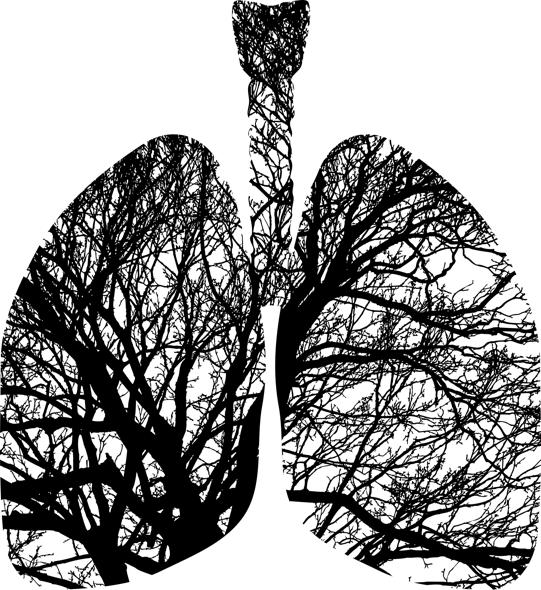 Punctured lung affects nearly 1 percent of COVID19 patients Medical