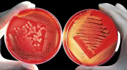 Pixabay Agar 60571 1280