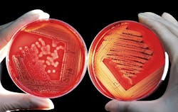 Pixabay Agar 60571 1280 5f9ac9a466e05 Pixabay Agar 60571 1280 5f9ac9a466e05