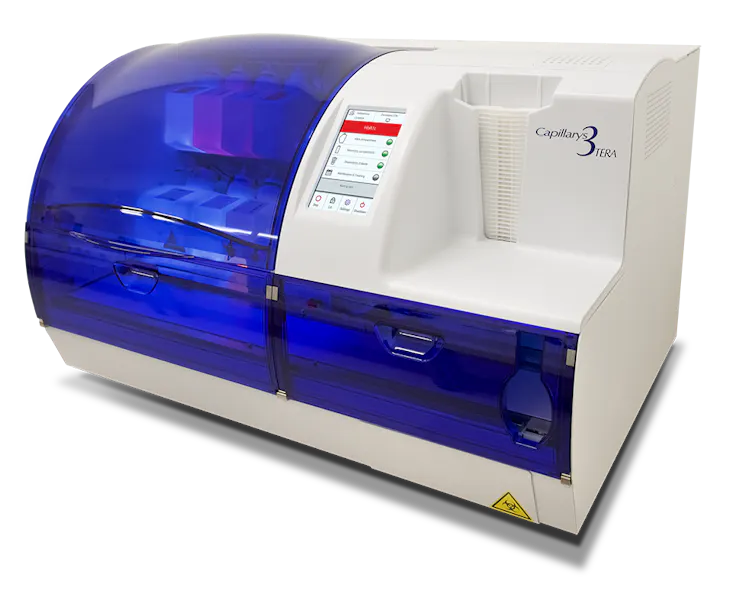 Sebia Capillary Testing Icon Product Focus - Diabetes | Medical Laboratory Observer