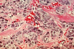 Nih 26289119085 Fce4719cdb K 5fb3d9cd1d320 Nih 26289119085 Fce4719cdb K 5fb3d9cd1d320