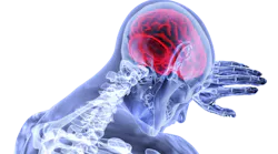 Pixabay Brain 3168269 1920