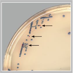 Box inset; GBS colonies (pink/red colonies; black arrows). Box inset; GBS colonies (pink/red colonies; black arrows).