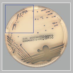 Software positive / manual read negative specimen (true positive GBS culture) Software positive / manual read negative specimen (true positive GBS culture)
