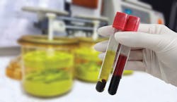 Hemolysis can affect the measurement results of specific analytes significantly Hemolysis can affect the measurement results of specific analytes significantly