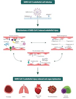 Figure 1: SARS-CoV-2-Induced Endothelial Injury A schematic of SARS-CoV-2 infection and proposed resulting endothelial injury. These insults interact with each other to cause end-organ dysfunction that is manifest in many COVID-19 patients. Figure 1: SARS-CoV-2-Induced Endothelial Injury A schematic of SARS-CoV-2 infection and proposed resulting endothelial injury. These insults interact with each other to cause end-organ dysfunction that is manifest in many COVID-19 patients.