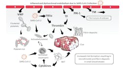Figure1. Scheme of the pathophysiological mechanisms of COVID-19-associated coagulopathy. Figure1. Scheme of the pathophysiological mechanisms of COVID-19-associated coagulopathy.