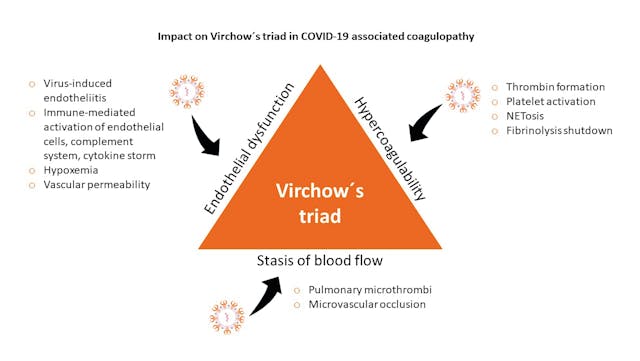 Figure 2. The impact of SARS-CoV-2 infection on Virchow&acute;s triad of thrombosis