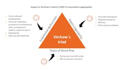 Figure 2. The impact of SARS-CoV-2 infection on Virchow´s triad of thrombosis Figure 2. The impact of SARS-CoV-2 infection on Virchow´s triad of thrombosis