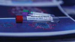Rapid molecular and antigen tests to detect SARS-CoV-2 deliver results quickly and efficiently