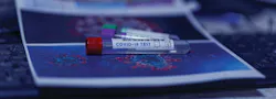 Rapid molecular and antigen tests to detect SARS-CoV-2 deliver results quickly and efficiently Rapid molecular and antigen tests to detect SARS-CoV-2 deliver results quickly and efficiently