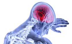 Pixabay brain covid 2 26 21
