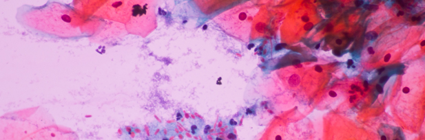 Disease 603ff18ae562f