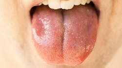 Pixabay saliva 3 29 21 6061d6b4d9ffd Pixabay saliva 3 29 21 6061d6b4d9ffd