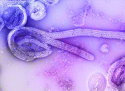 Unsplash ebola 3 1 21 603ce8e9eb6a2 Unsplash ebola 3 1 21 603ce8e9eb6a2