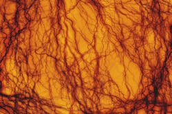 Pixabay bloodvessel 4 7 21 606ce26acc217 Pixabay bloodvessel 4 7 21 606ce26acc217