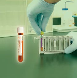 Inteli Q Diabetes Qc Art By Bio Rad 60a6adff652fb Inteli Q Diabetes Qc Art By Bio Rad 60a6adff652fb