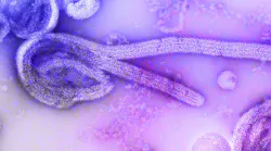 Pixabay ebola 5 4 21