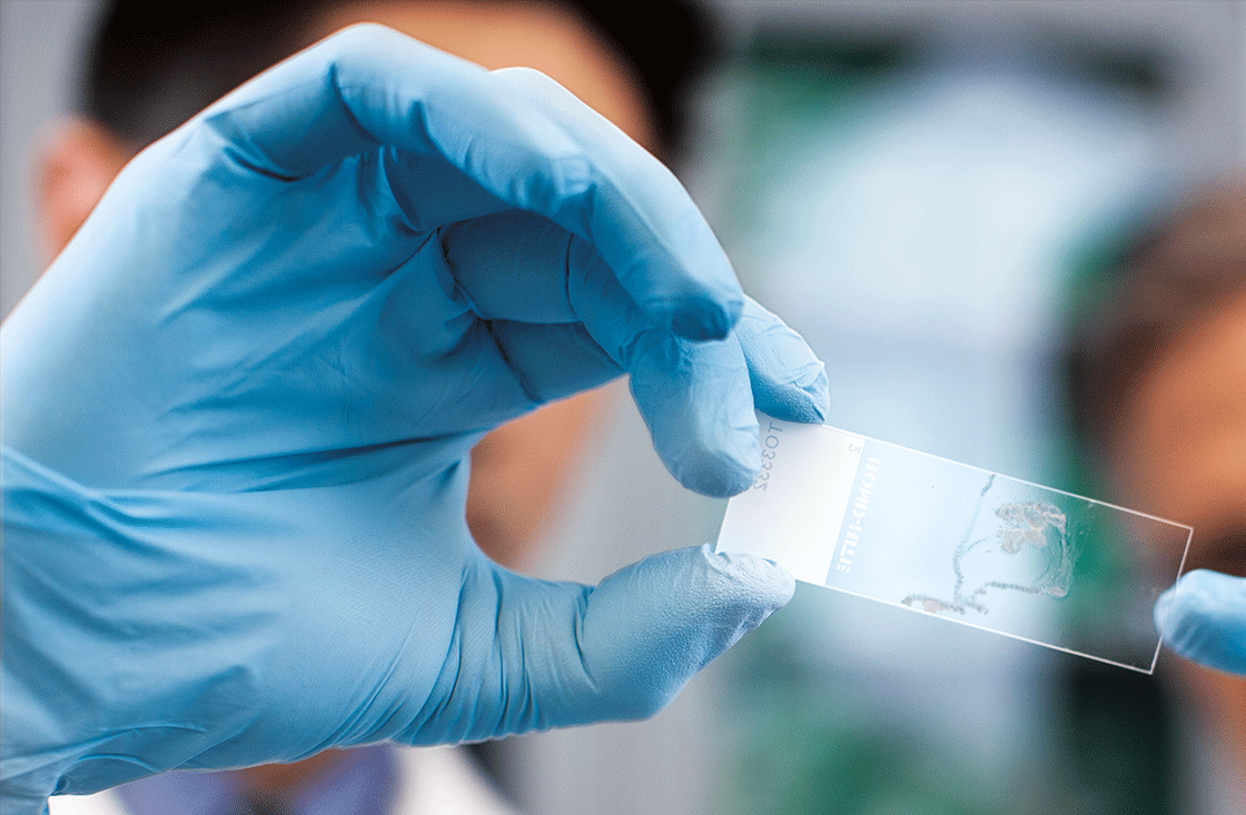 Liquid Biopsy Photo Courtesy Of Roche Diagnostics 60ca5b0369212