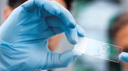 Liquid Biopsy Photo Courtesy Of Roche Diagnostics