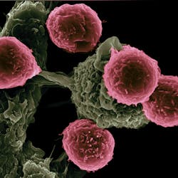 T Cells Photo By National Cancer Institute On Unsplash 6103f52a2e2f1 T Cells Photo By National Cancer Institute On Unsplash 6103f52a2e2f1