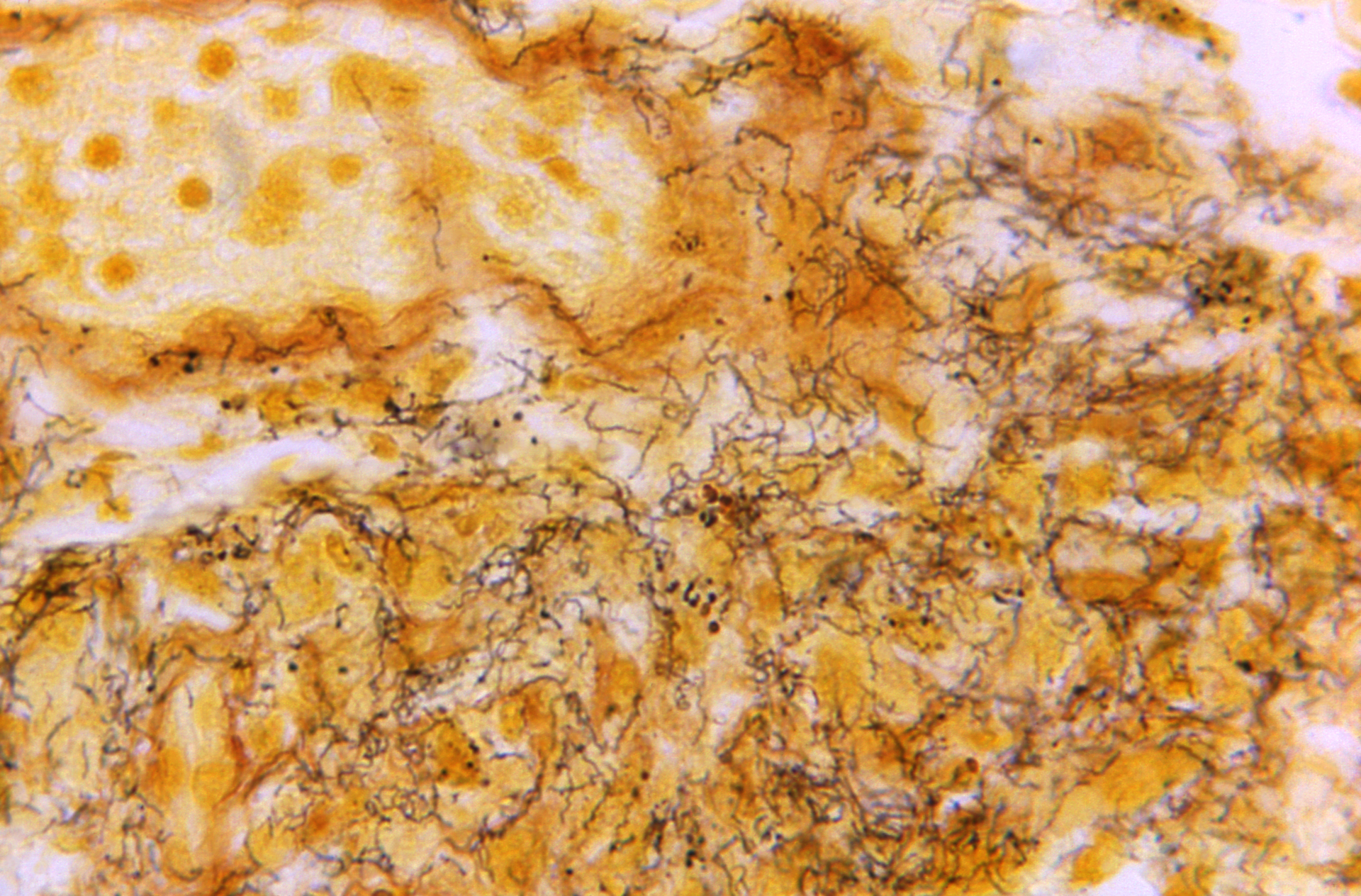 From Cdc 21621 60ec4a4b92d67