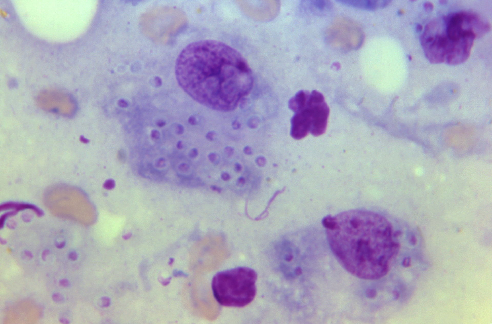 Macrophage Courtesy Cdc