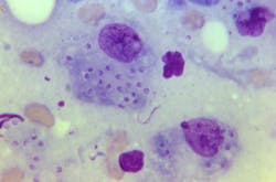 Macrophage Courtesy Cdc 60f6c94a290cf Macrophage Courtesy Cdc 60f6c94a290cf