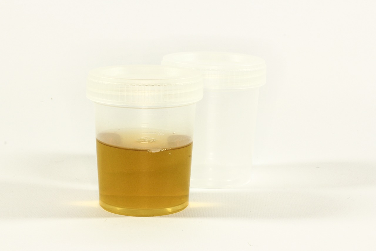 Antimicrobial Susceptibility Test Breakpoint Updates Challenges And   Urine The Test 1006794 1280.6104051b81c02 