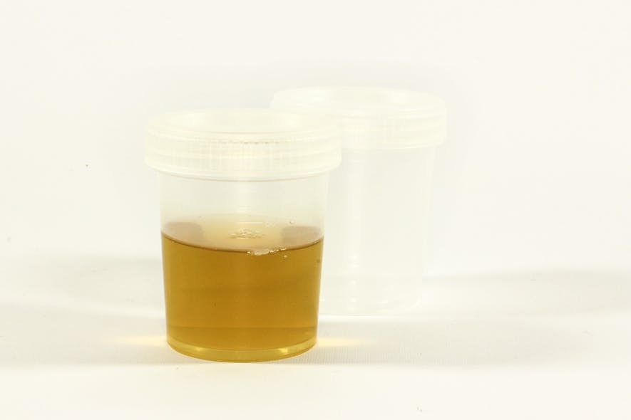 Urine The Test 1006794 1280
