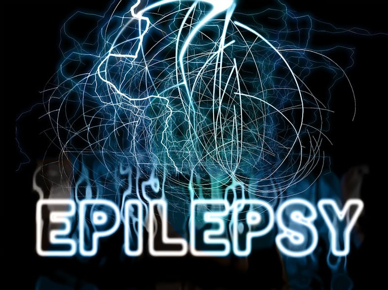 Pixabay Epilepsy Fire 563315 1280