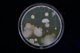 Bacterial Culture Photo By Michael Schiffer On Unsplash
