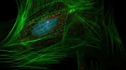 Cancer Fibroblast Photo By National Cancer Institute On Unsplash