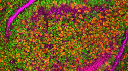 Leukemia Fruitfly Photo By National Cancer Institute On Unsplash