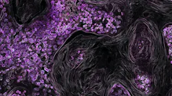 Lung Cancer Kras Photo By National Cancer Institute On Unsplash