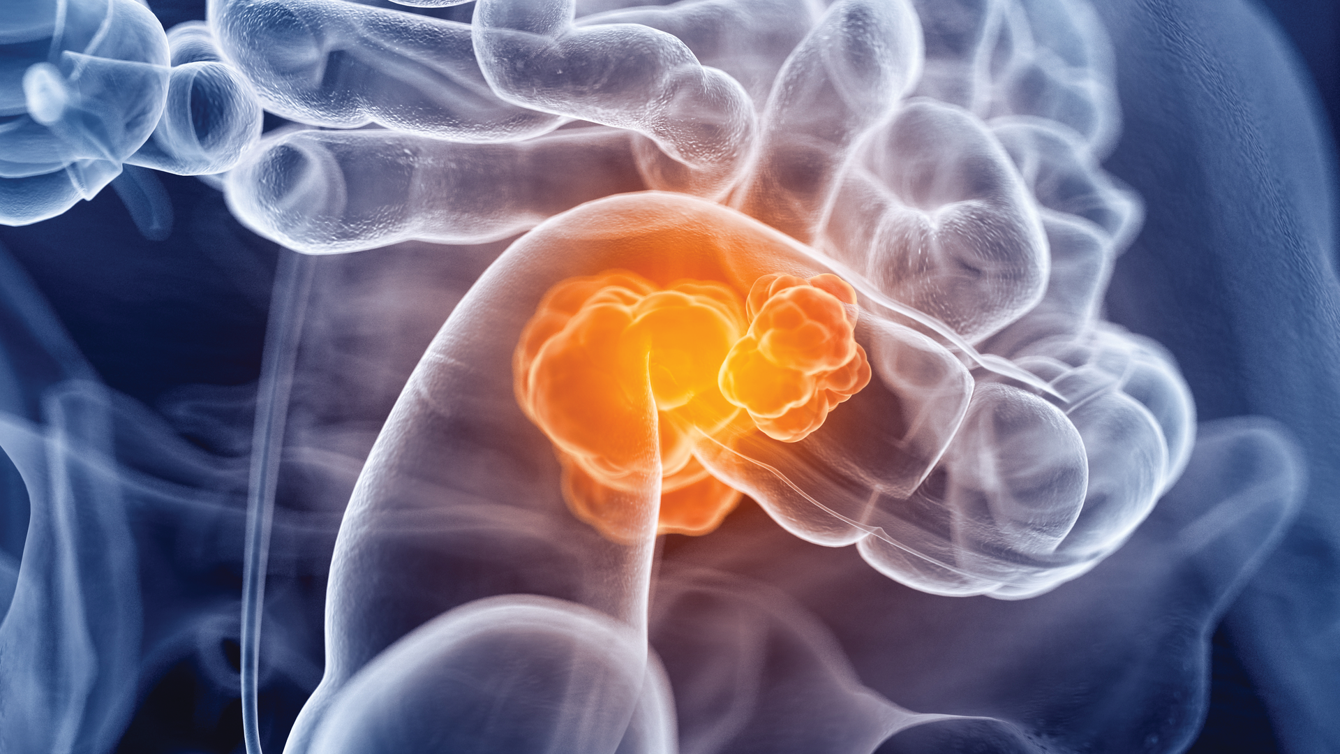 Adobe Stock 114430220 6143a14ccbe3c