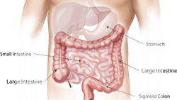 Abdomen 1698565 1920 Image By Bodymybody From Pixabay 614c7bca4450a Abdomen 1698565 1920 Image By Bodymybody From Pixabay 614c7bca4450a