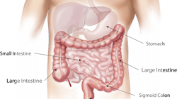 Abdomen 1698565 1920 Image By Bodymybody From Pixabay 614c7bca4450a Abdomen 1698565 1920 Image By Bodymybody From Pixabay 614c7bca4450a