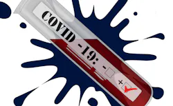 Pixabay Coronavirus 5675406 1920 614ddd4b5d481 Pixabay Coronavirus 5675406 1920 614ddd4b5d481
