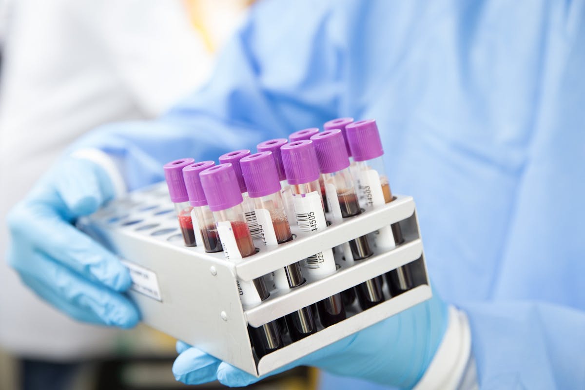 Blood Samples In Tubes Image By Ahmad Ardity From Pixabay