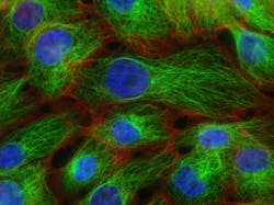 Breast Stress Fibers Cancer Photo By National Cancer Institute On Unsplash 612f745bedd74 Breast Stress Fibers Cancer Photo By National Cancer Institute On Unsplash 612f745bedd74