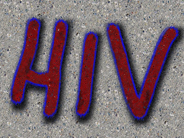 Take home HIV test kits produce results Medical Laboratory Observer