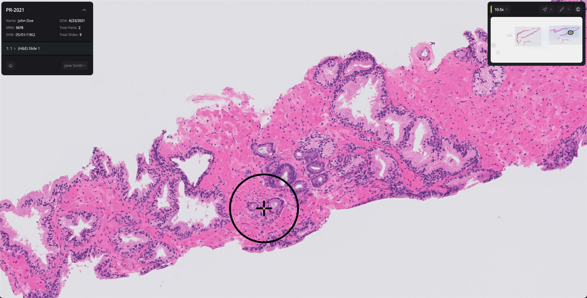 Prostate Cancer Courtesy Of Paige Ai 614c82de1bf60