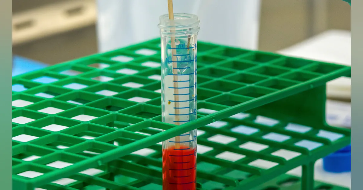 Researchers note high toxin levels linked to more severe C. difficile ...