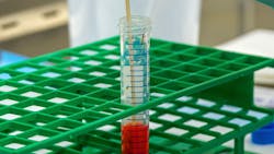 Stool Sample Photo By Cdc On Unsplash 61771fb3727be Stool Sample Photo By Cdc On Unsplash 61771fb3727be