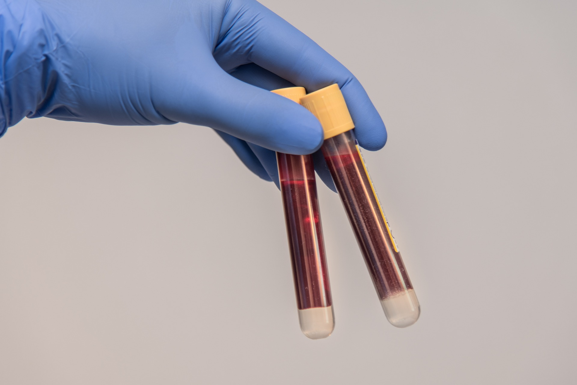 Blood Sample 6200016 1920 61701c06533e0