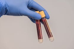 Blood Sample 6200016 1920 61701c06533e0 Blood Sample 6200016 1920 61701c06533e0