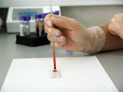Blood Smear Image By Public Domain Pictures From Pixabay 615af20a399ea Blood Smear Image By Public Domain Pictures From Pixabay 615af20a399ea