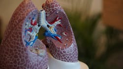 Lung Model Photo By Robina Weermeijer On Unsplash 617aacdb85df5 Lung Model Photo By Robina Weermeijer On Unsplash 617aacdb85df5